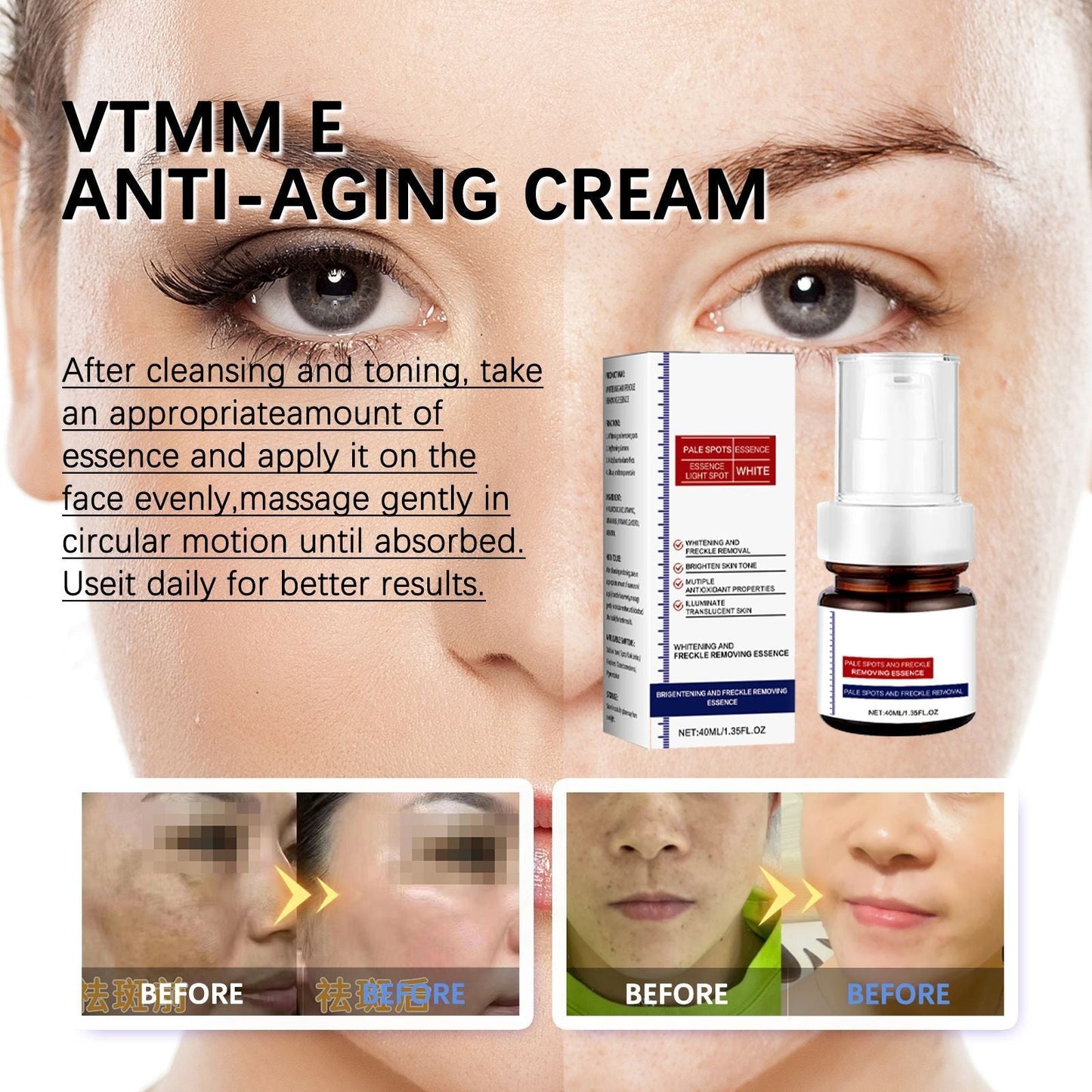 🔥3-day freckle removal: Freckles Disappear, Pigmentation Dissipates, and Skin looks brand New! ✨Vitamin C Freckle Removal Essence➡️