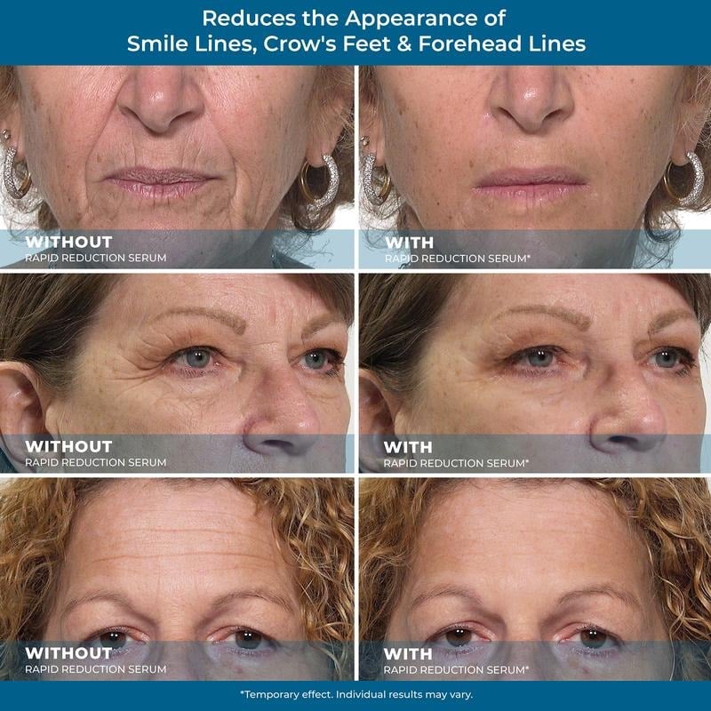 24-Hour Flash Deal⏰✨ Rapid Reduction Eye Serum – Instant Tightening & Anti-Aging for Eyes & Face (20ml) ✨