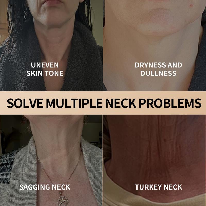 ✨ Transform Your Neck in 28 Days - 49% OFF - 🌟 Firming & Lifting Neck Cream - For Youthful, Radiant Skin!