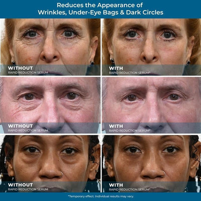 24-Hour Flash Deal⏰✨ Rapid Reduction Eye Serum – Instant Tightening & Anti-Aging for Eyes & Face (20ml) ✨