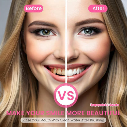 🦷 Niacinamide Whitening Toothpaste - For Healthier, Whiter Teeth!