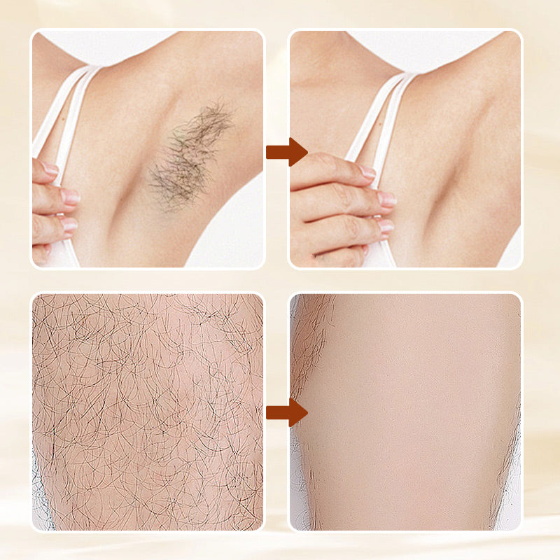 ⏰Last Day Buy 2 Get 1  FreeVersatile Aromatic Mild Formula Hair Removal Cream