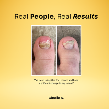 7 Day Nail Treatment Serum🍃Natural ingredients & Fast results